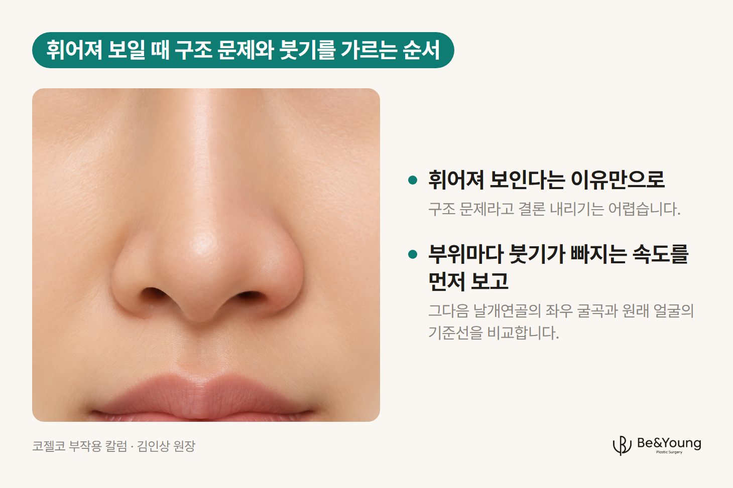 정면에서 좌우 붓기 속도 차이로 한쪽이 기울어 보이는 코를 그린 일러스트