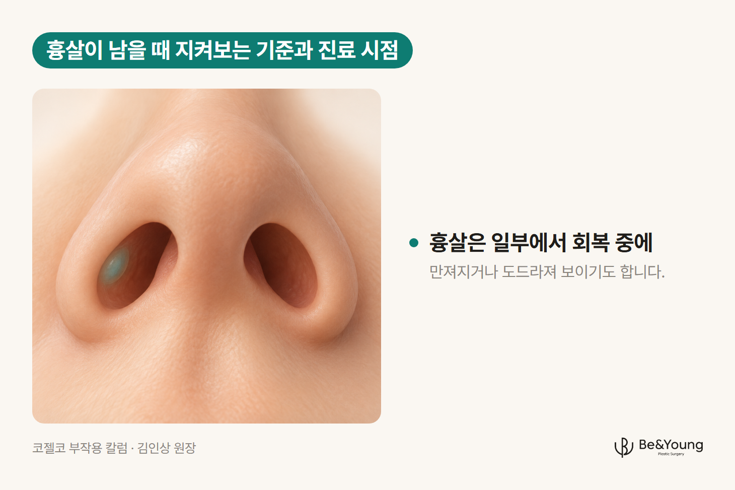 코끝과 콧구멍 안쪽에서 도드라진 한 부위를 표시한 클로즈업 일러스트