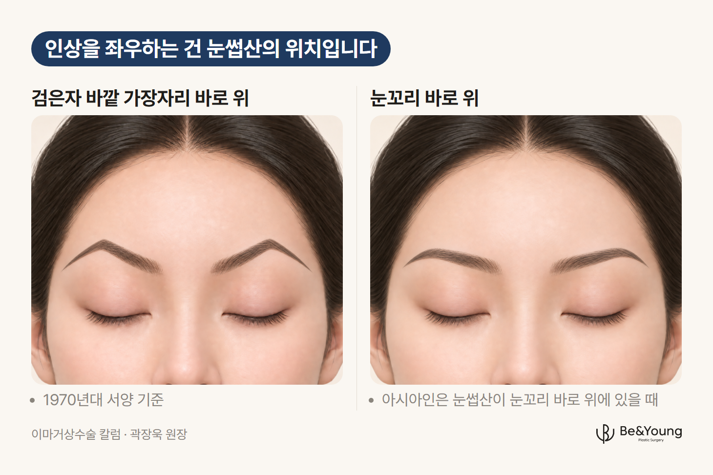 이마거상 계획에서 비교하는 두 눈썹산 위치. 검은자 바깥 가장자리 위의 각진 눈썹과 눈꼬리 위의 완만한 눈썹을 같은 정면 얼굴에 나란히 둔 모습