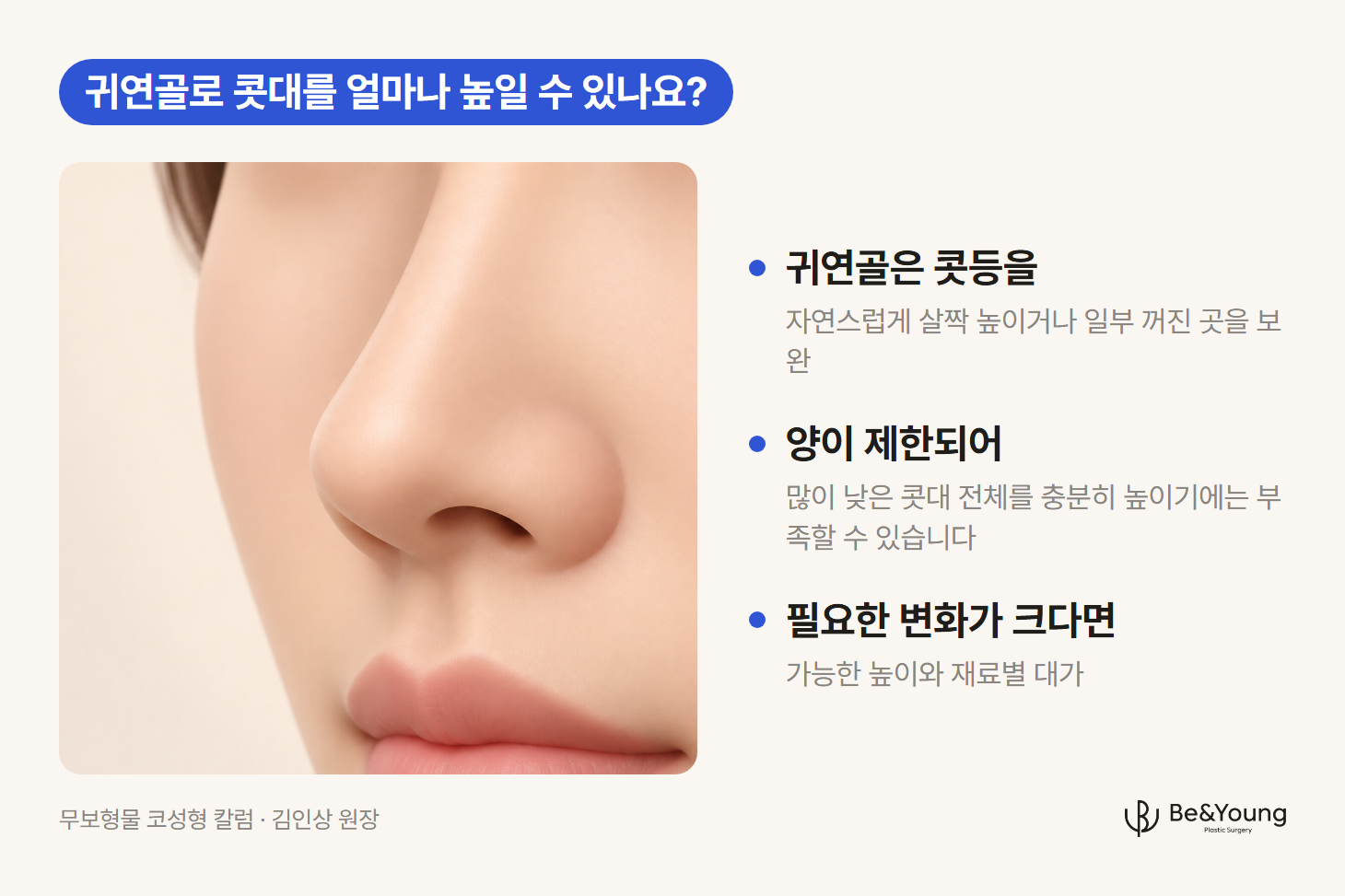 귀연골로 콧등을 자연스럽게 살짝 높이거나 일부 꺼진 곳을 보완한 범위를 사면에서 보여주는 일러스트