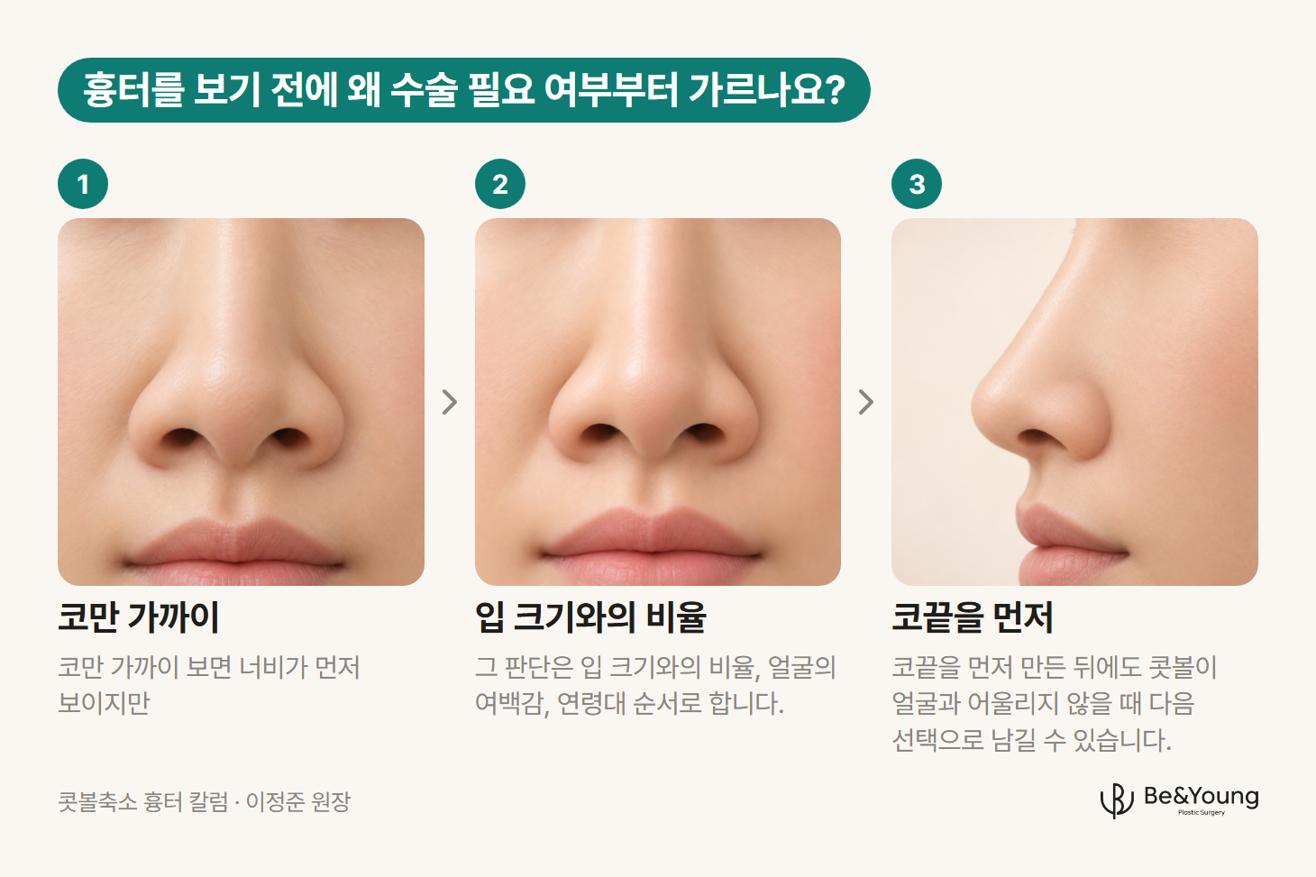 콧볼축소 흉터를 걱정할 때 수술 필요 여부를 살피기 위해 콧볼 확대 모습, 코와 입의 비율, 코끝 측면을 순서대로 보여 주는 그림