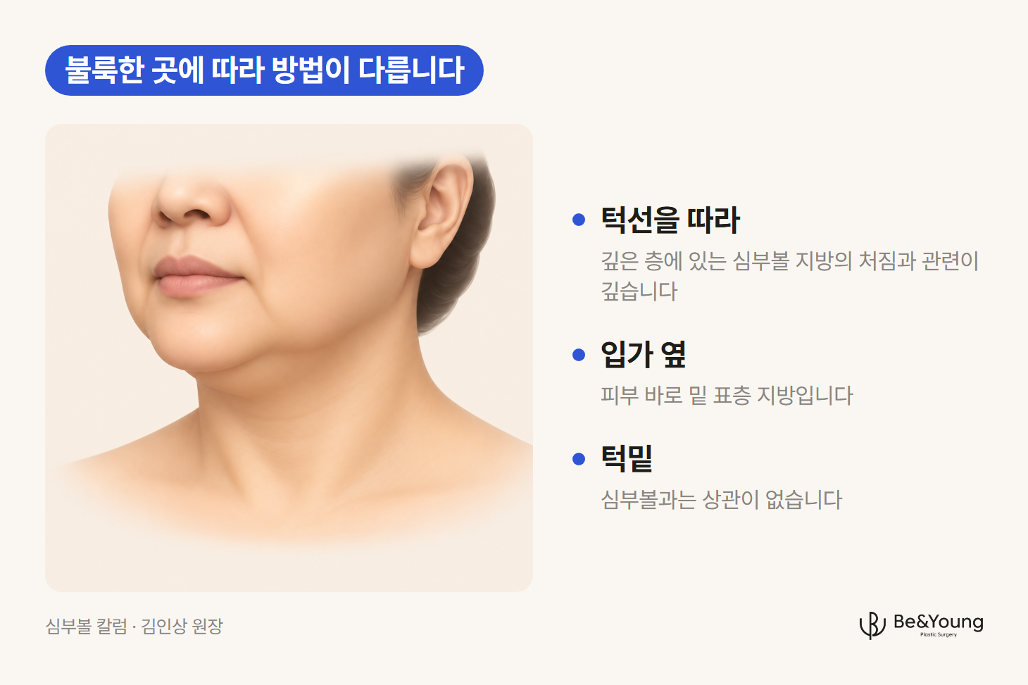 심부볼을 설명하기 위해 볼살이 턱선을 따라 불룩하게 처지고 입가 옆과 턱밑이 볼록한 모습을 그린 얼굴 아래쪽 그림