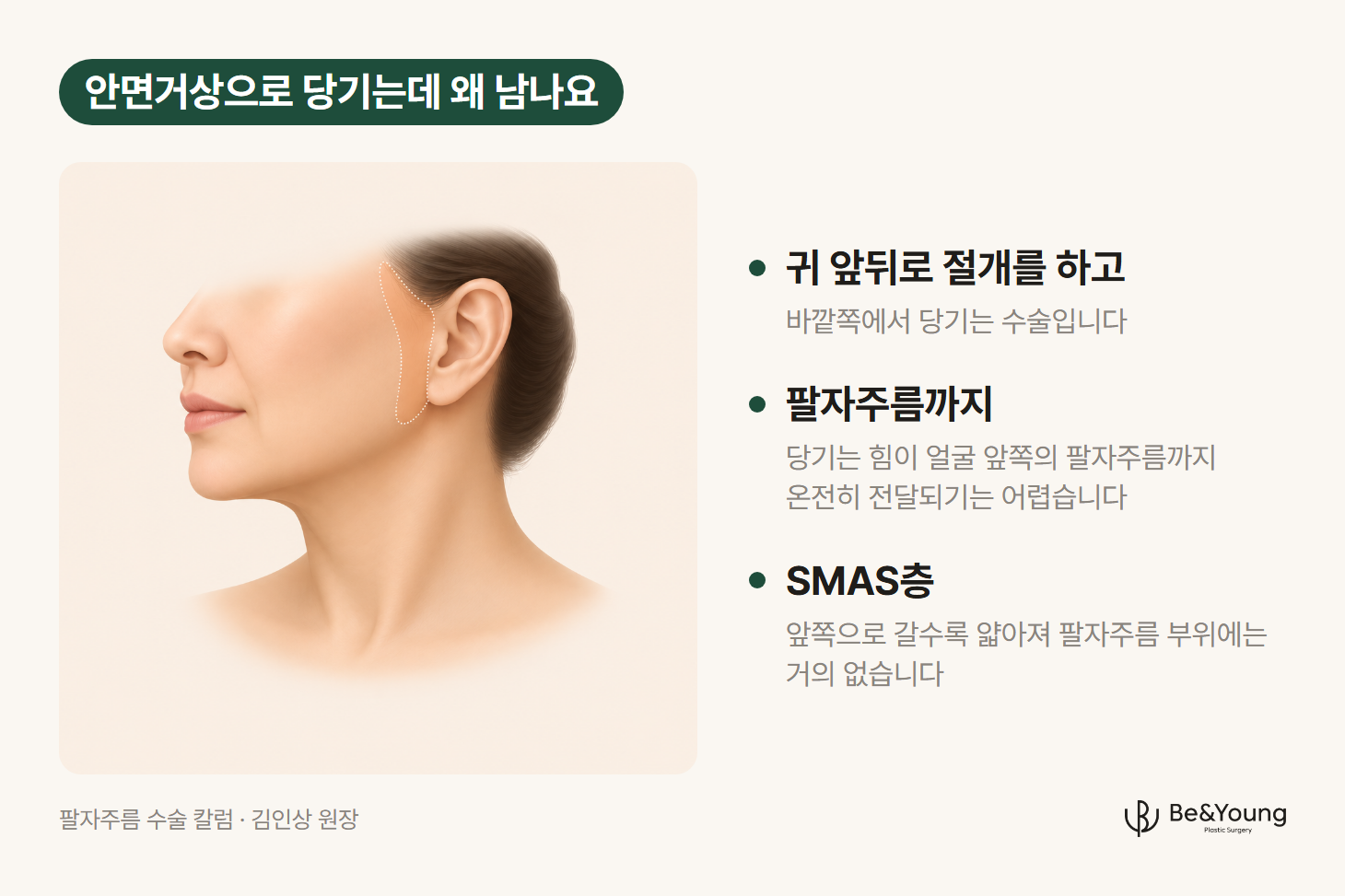 귀 앞쪽을 옅은 색으로 표시한 얼굴 아래쪽 옆모습 그림. 귀 앞뒤에서 당기는 힘이 얼굴 앞쪽의 팔자주름까지 온전히 전달되기 어렵다는 설명