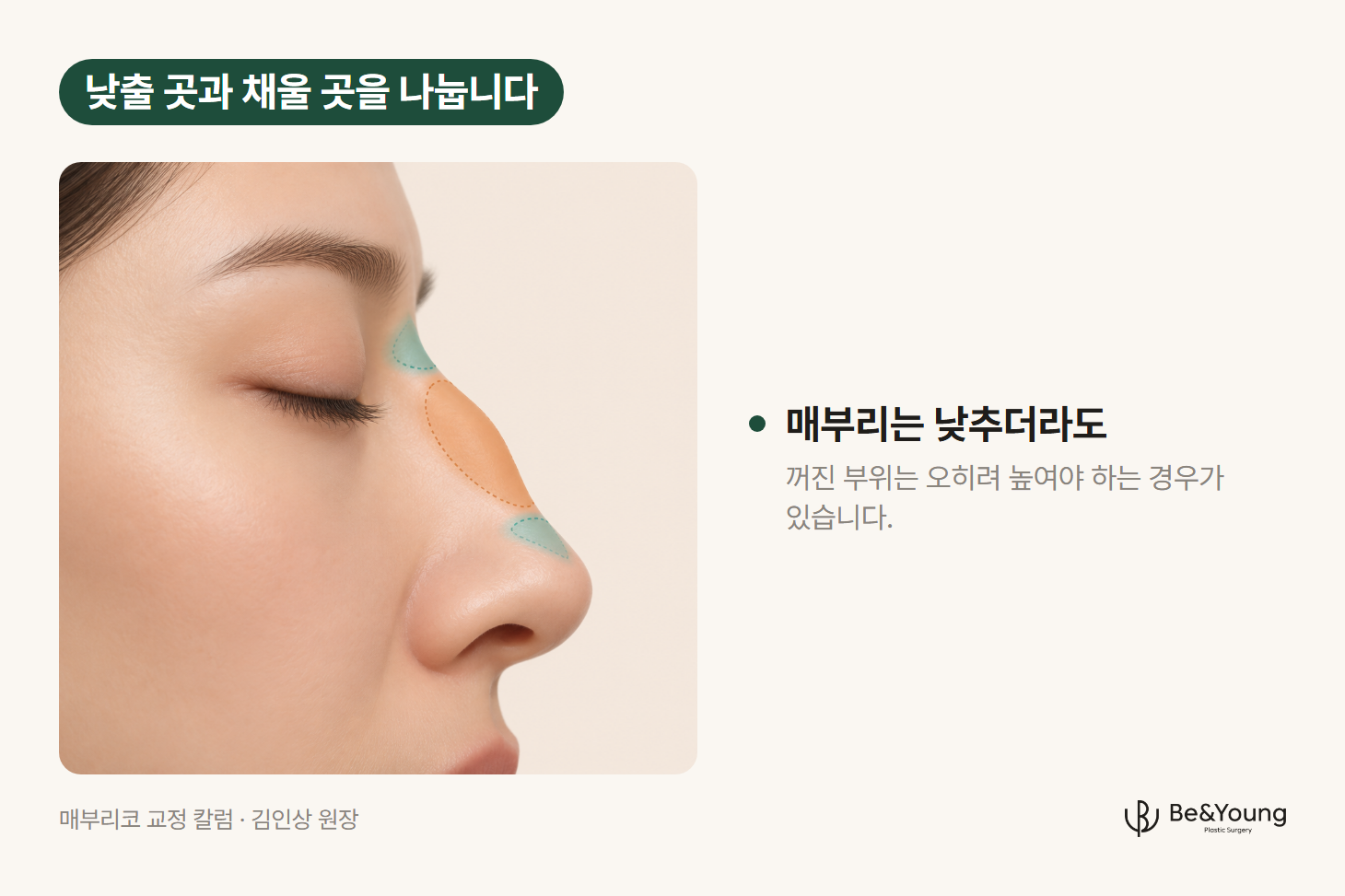 매부리는 낮추고 미간과 코끝 바로 위는 높여야 하는 자리를 옆모습에 표시한 일러스트