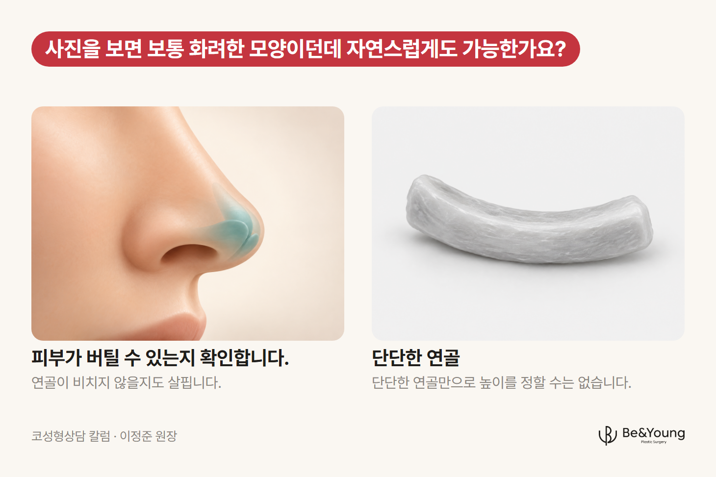 코성형 상담에서 확인하는 코끝의 피부와 연골을 보여 주는 측면 모습과 연골 조각을 나란히 둔 일러스트
