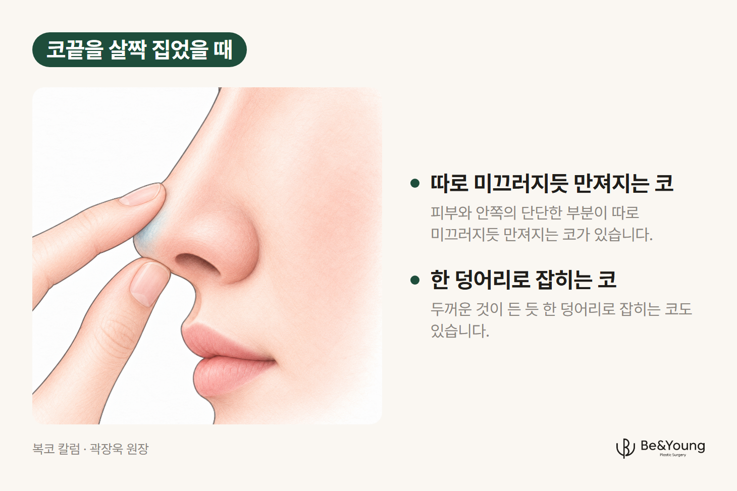 복코 원인을 가늠하는 방법, 손가락 두 개로 코끝을 살짝 집어 피부가 따로 움직이는지 한 덩어리로 잡히는지 보는 손그림