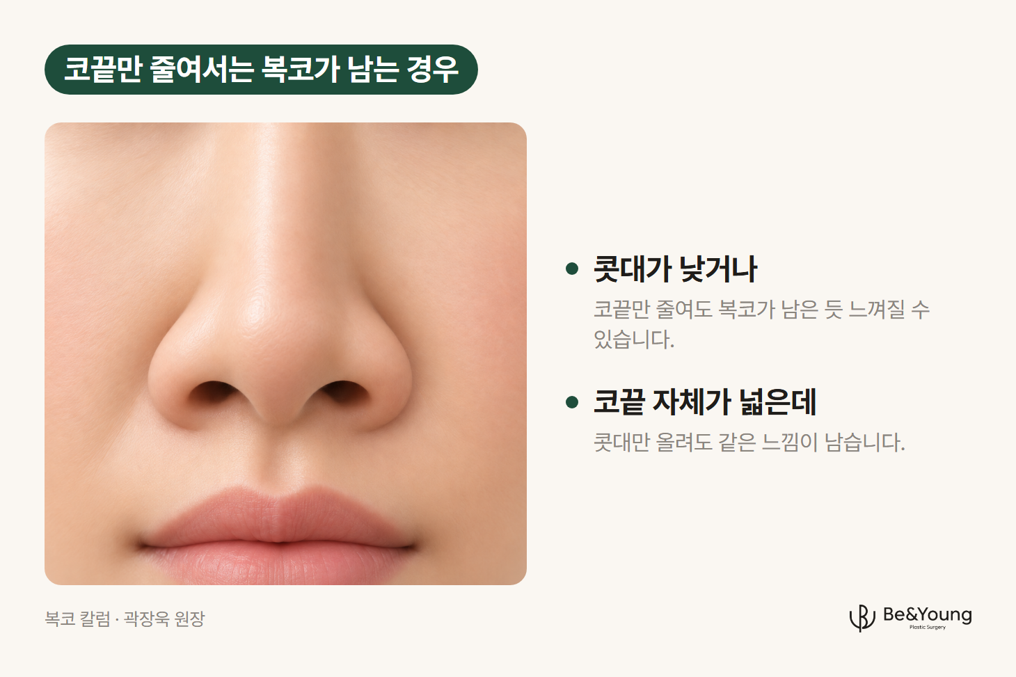 복코 수술 전 확인할 원인, 코끝이 둥글고 넓어 보이는 코를 정면에서 본 일러스트