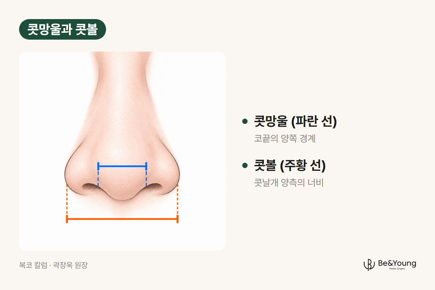 복코를 볼 때 나누어 보는 두 너비를 설명하기 위해, 정면에서 본 코 하나에 코끝 양쪽 경계 사이의 너비는 파란 가로선으로, 양쪽 콧날개 바깥 끝 사이의 너비는 주황 가로선으로 표시하고 점선 안내선을 그은 그림