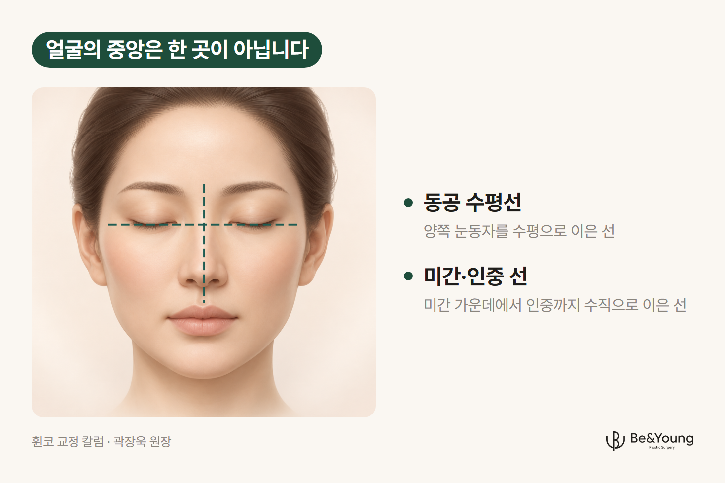 휜코 교정에서 코를 맞출 얼굴의 두 기준선, 동공 수평선과 미간·인중 선을 정면 얼굴에 점선으로 표시한 일러스트