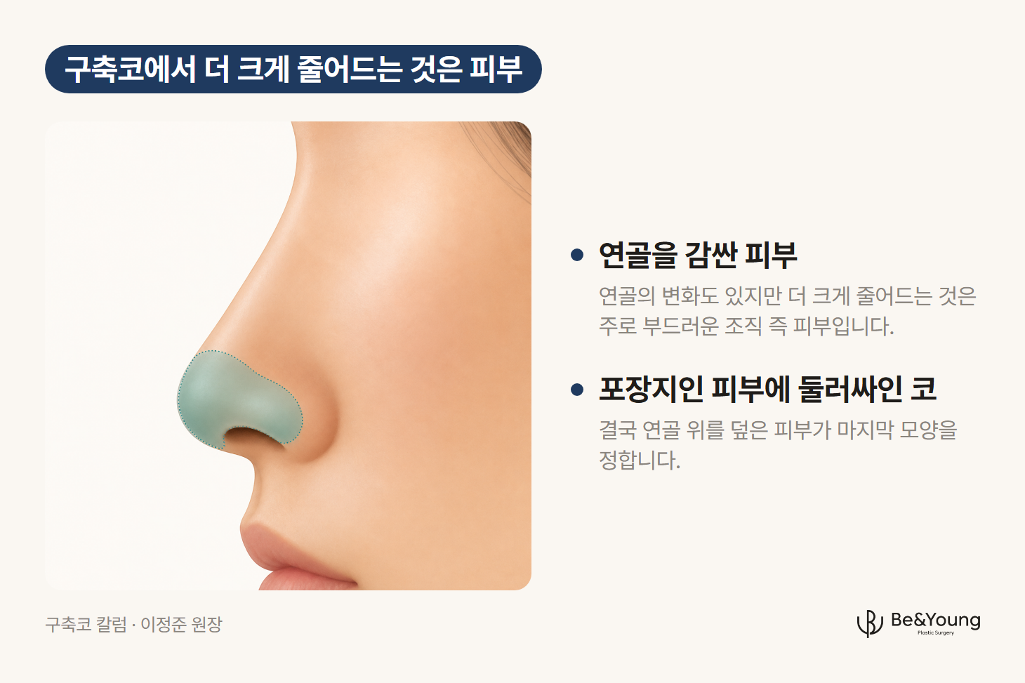 구축코에서 피부가 줄어드는 원인을 설명하기 위해 옆에서 본 코끝의 피부와 연부조직 범위를 색으로 표시한 그림