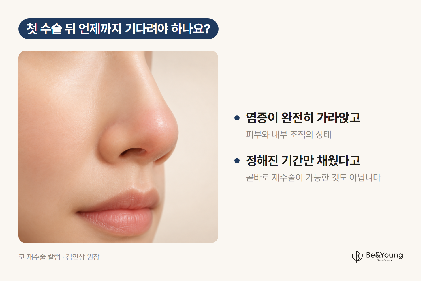 코 재수술은 언제부터 가능한가요?