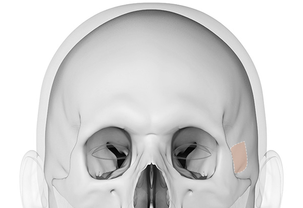 Type-Specific Rhinoplasty