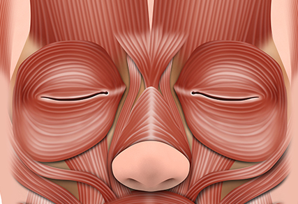 Endoscopic Forehead Lift